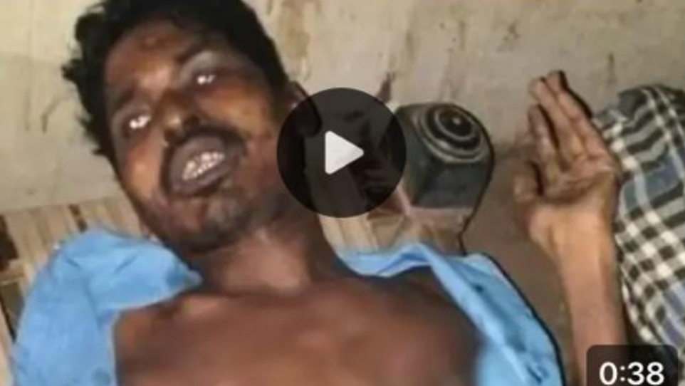 तांत्रिक ने युवक को गर्म त्रिशूल से चलाया भूत भगाने 4 दिन झाड़-फूंक की इंफेक्शन से मौत आरोपी गिरफ्तार