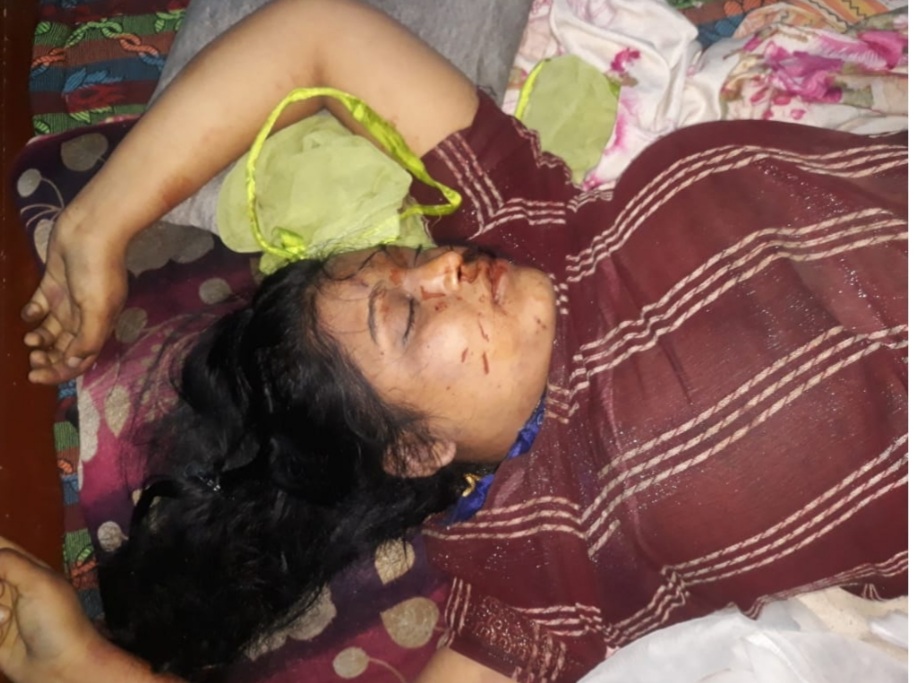 सिविल लाइन थाना क्षेत्र में प्रेग्नेंट युवती की हत्या, पुलिस को पति पर शक