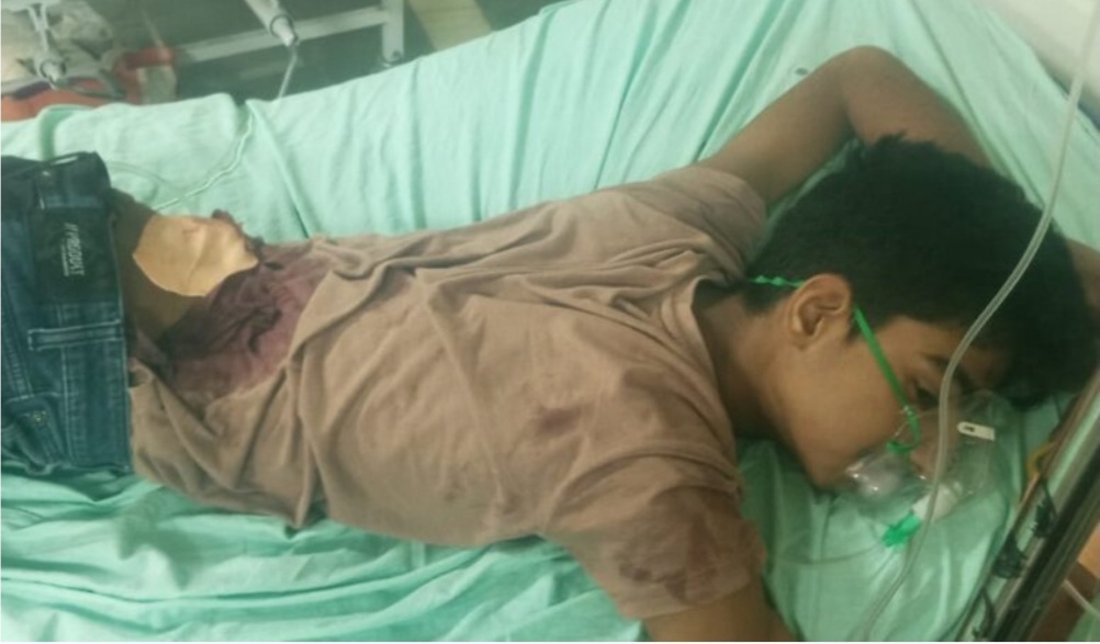 तोरवा क्षेत्र में चाकू बाजी