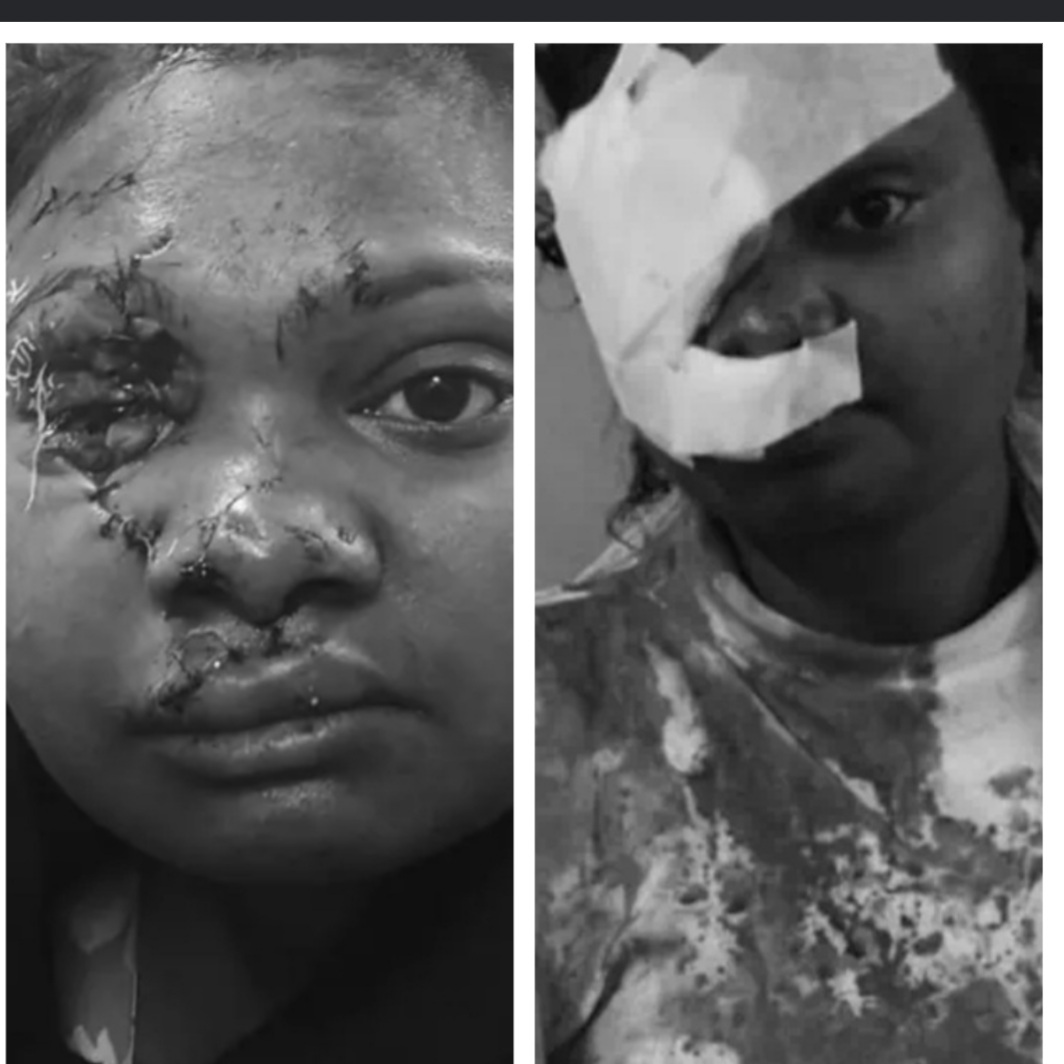 रायपुर के बार में गर्लफ्रेंड का मर्डर, बॉयफ्रेंड ने शराब की बोतल से फोड़ा गर्लफ्रेंड का सिर